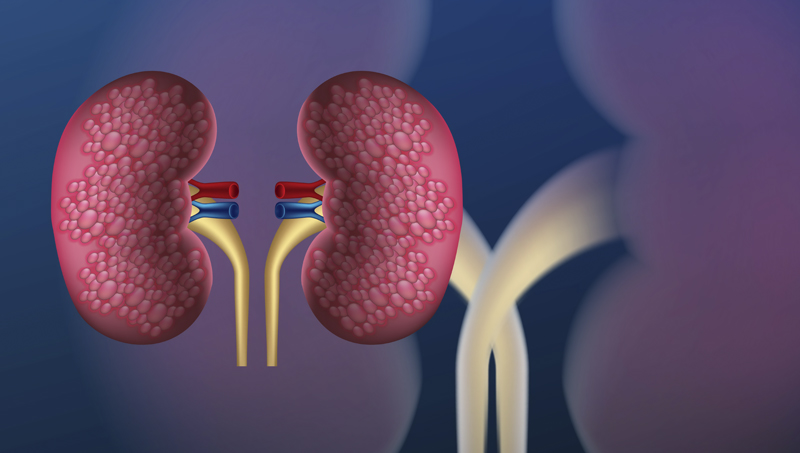 Best Kidney Doctor in India 