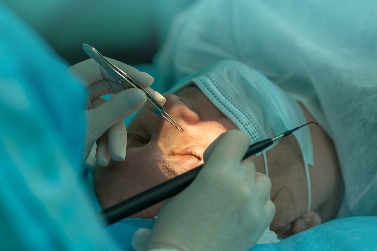 Cornea Transplant Surgery in India